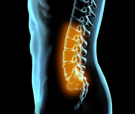 腰椎間盤突出的危害，怎么才能更有效治愈？（圖）_3