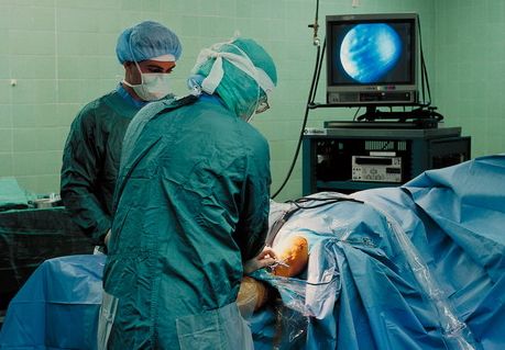 喬氏冷敷貼分享膝關(guān)節(jié)炎改善要選擇正確療法(圖)_2