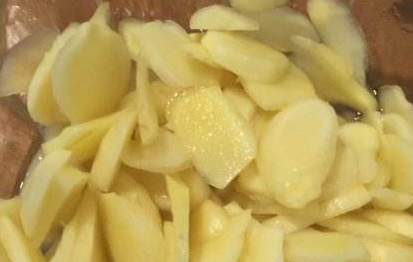 喬氏冷敷貼分享膝關(guān)節(jié)炎改善要選擇正確療法(圖)_4