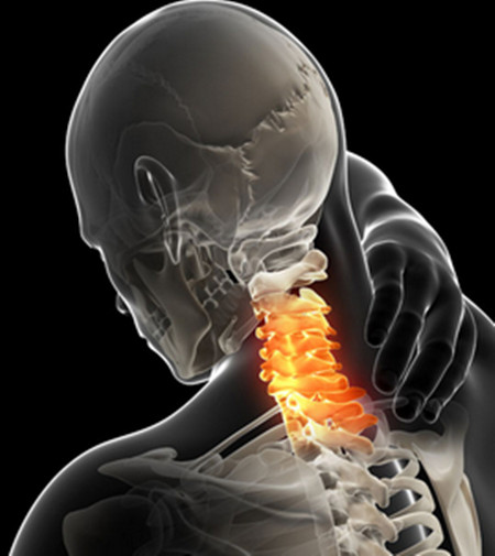 頸椎病得不到有效的控制會怎么惡化？_2