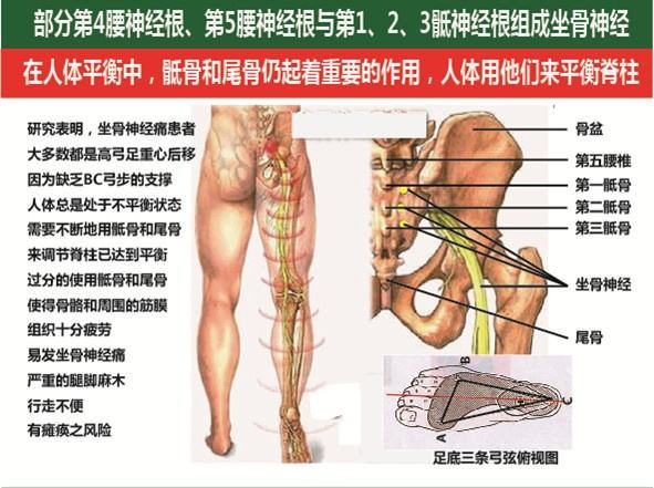 腰间盘突出疼痛难忍应该如何选择改善方式_1