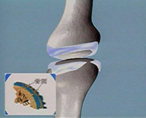 王九正貼提示生活認(rèn)知三大誤區(qū)可能會導(dǎo)致骨質(zhì)增生無法治愈_1