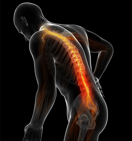 腰椎間盤突出不要慌，找對(duì)改善方法是關(guān)鍵_2