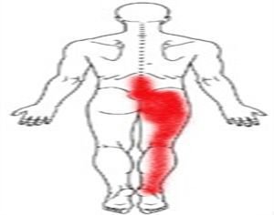 坐骨神經(jīng)痛日常預(yù)防 王九正貼改善坐骨神經(jīng)痛效果好_1