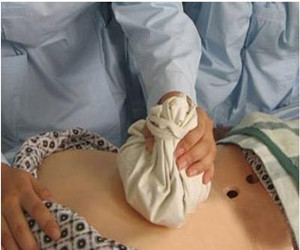 坐骨神經(jīng)痛選擇什么方法改善才是最好的？_2