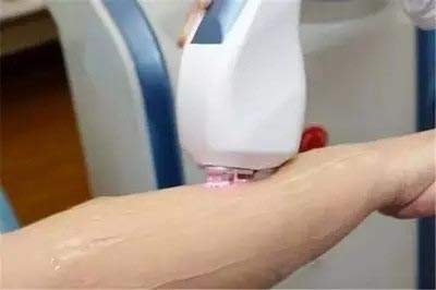 脫毛儀器排行榜（圖）_2