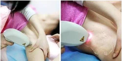 2017美容院美容儀排行（圖）_4