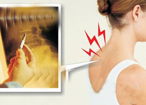 改善頸椎病最有效的幾種方法，值得收藏_1