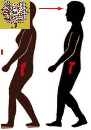 年紀輕輕怎么會腰間盤突出？該如何養(yǎng)護？_4