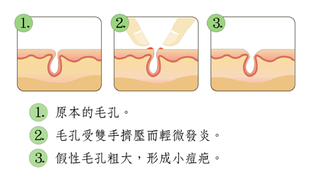 皮膚管理培訓中心皮膚管理解決的8大皮膚問題（圖）_2