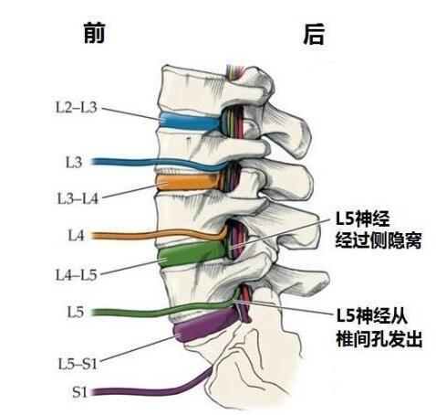 尽早明了腰突危害 趁早选择正确的改善方案_2