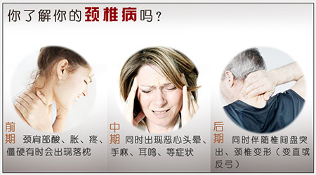 頸椎病怎么改善好？有哪些方法比較好_2