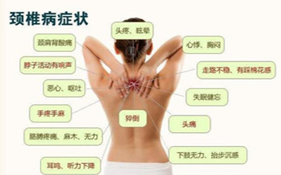 頸椎病導(dǎo)致頭暈惡心?看看中醫(yī)如何改善_2