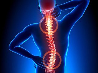 腰椎間盤突出壓迫脊椎神經(jīng) 王九正貼有效改善_1