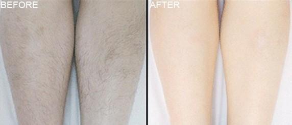 美容儀器價(jià)格排行榜（圖）_2