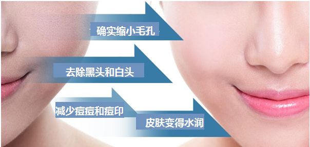 美容儀器價(jià)格排行榜（圖）_3