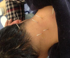 頸椎病困擾多年如何改善才能擺脫_3