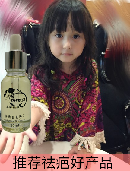 去除痤瘡性疤痕用的什么方法效果好？_4