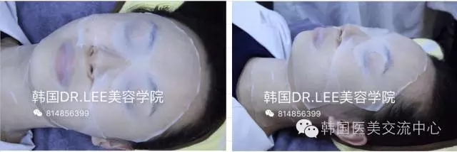 想要V臉不用愁，韓國(guó)皮膚管理來(lái)幫您（圖）_2