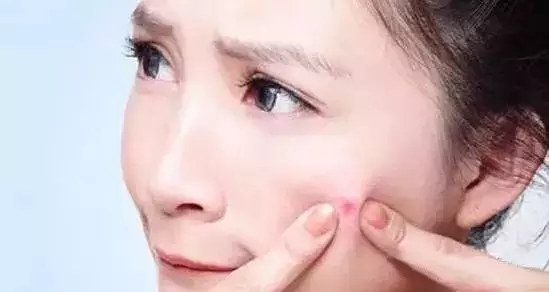 擁有韓國皮膚管理——從此肌膚光滑無暇（圖）_3