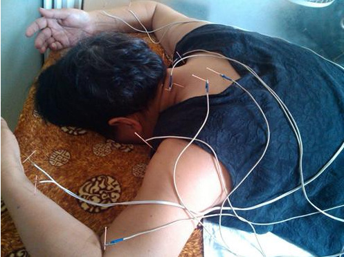 患了頸椎病有誤區(qū)嗎 怎么改善頸椎病呢？_4