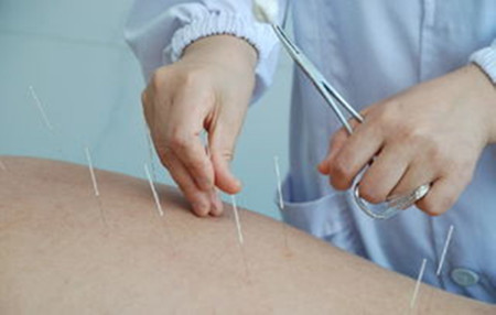 中藥外貼是膝關節(jié)炎最有效的改善方法（圖）_3