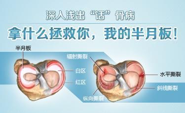 半月板損傷有哪些癥狀表現(xiàn)怎么改善？_1