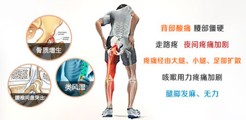 腰椎間盤突出改善方法大全，哪種方法更適合_1