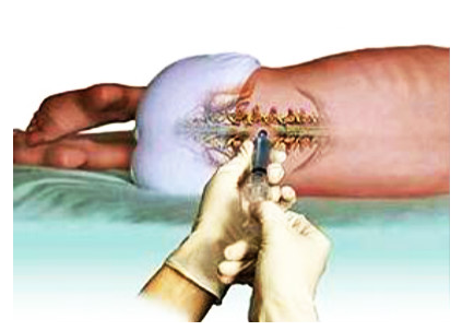 分享腰椎間盤突出主要原因以及各個(gè)階段的改善方法_2