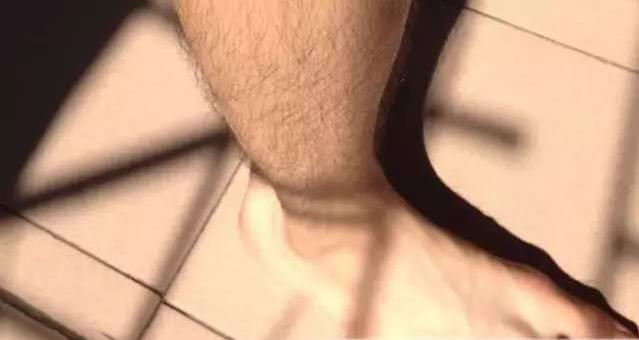 腿上有毛不敢穿裙子怎么辦_1