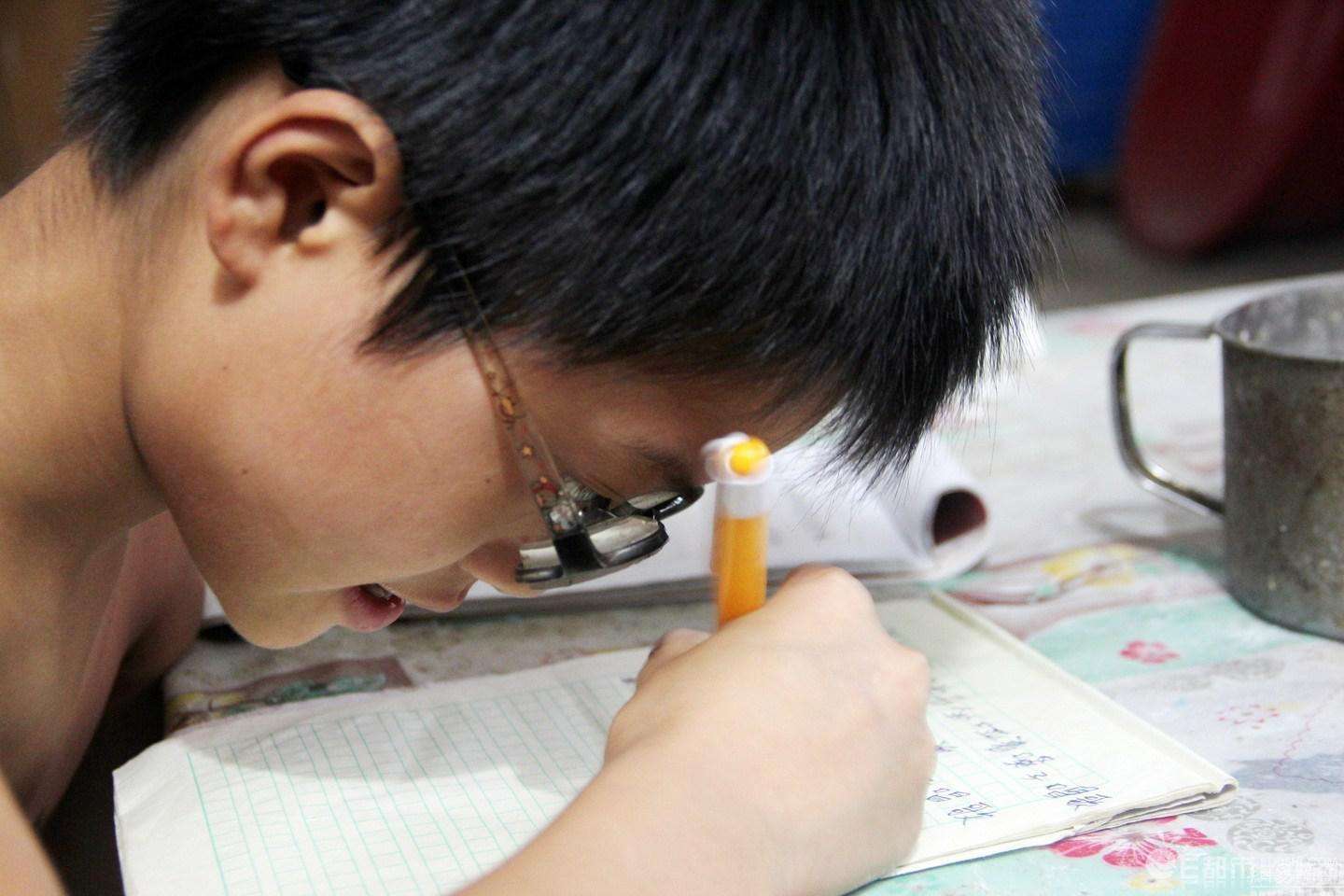 600度高度近視會(huì)導(dǎo)致失明－億視寧分享（圖）_1