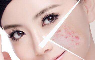 皮膚管理-肌膚保濕大法-輕松擁有嬰兒?。▓D）_5