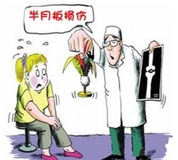 半月板損傷改善方法哪些是有效果的_1