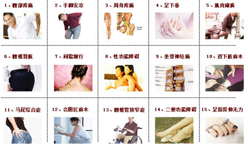 統(tǒng)計(jì)腰腿疼痛腰突的幾大類型，怎么治呢？王九正貼_2