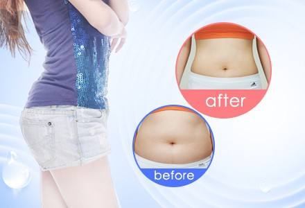 爆脂減肥儀器哪里有賣（圖）_1