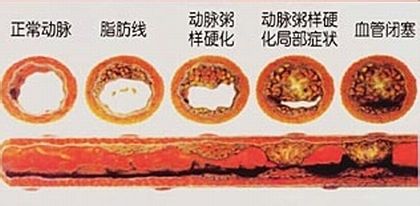 藍莓中的花青素讓您遠離血管疾病_4