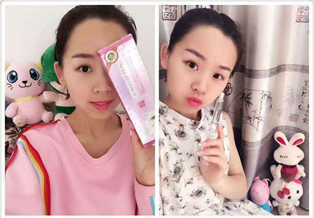 背部長痘？俏美時(shí)代有護(hù)膚妙招（圖）_2