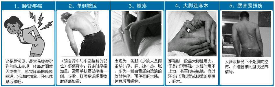 怎么治腰椎間盤突出，需要注意什么_2