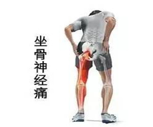 腰椎間盤突出發(fā)病率居高不下，改善方法選對了嗎_1