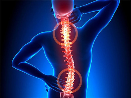 腰椎間盤突出花大錢做改善還不如保守改善_1