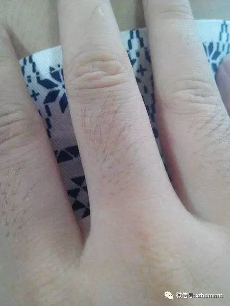 808半導體脫毛儀器（圖）_1