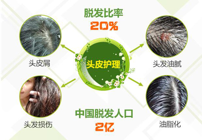 養(yǎng)發(fā)館加盟哪家好呢？（圖）_1