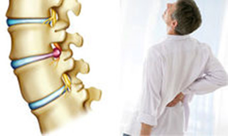 腰椎間盤(pán)突出總是反復(fù)發(fā)作，是不是方法沒(méi)找對(duì)？（圖）_1