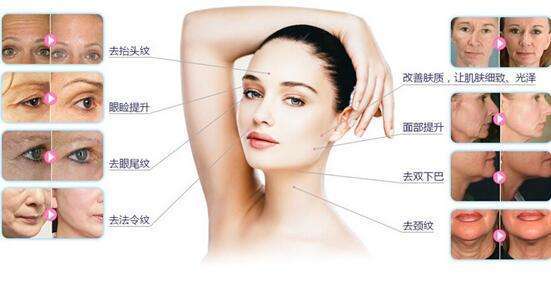 美容院專用面部超聲刀哪種效果好（圖）_2