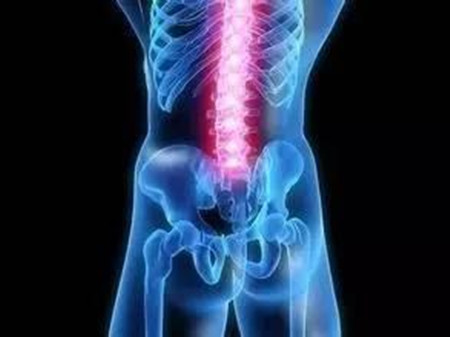 已經(jīng)壓迫神經(jīng)后的腰椎間盤突出這樣治改善果最佳？_2