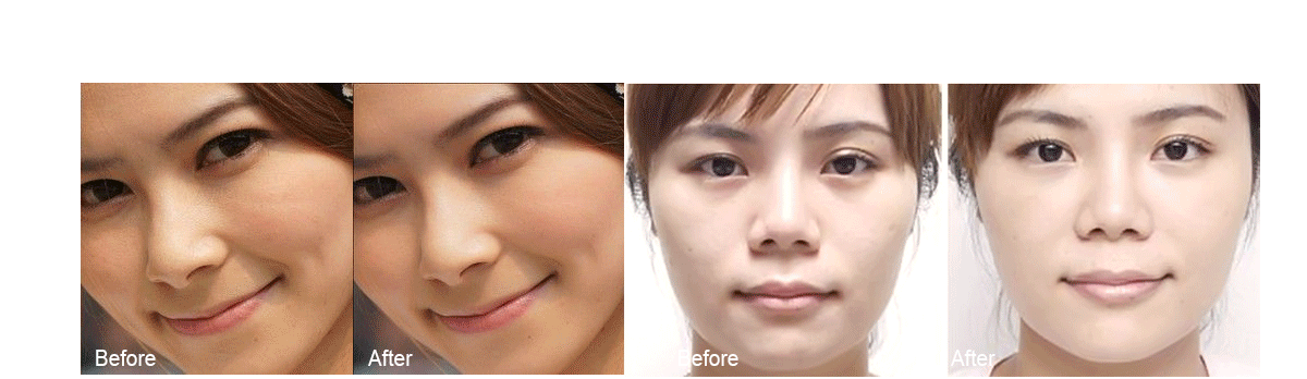 關于超微小氣泡你需要知道的都在這了!（圖）_19