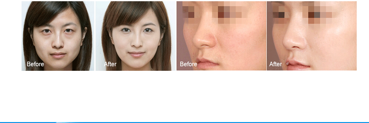 關于超微小氣泡你需要知道的都在這了!（圖）_20