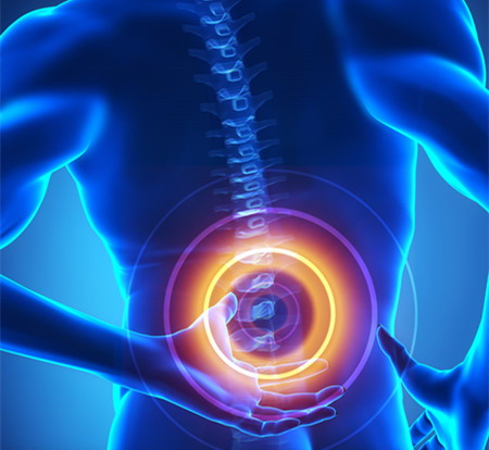 患上腰椎間盤突出自我診斷和自我改善方法_1