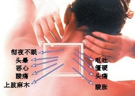 改善多年嚴重的頸椎病好方法新鮮出爐_1