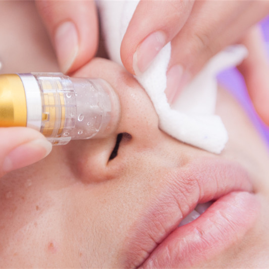 韓國(guó)皮膚管理小氣泡多少錢一臺(tái)（圖）_2